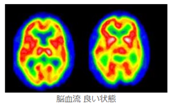 脳 良い状態