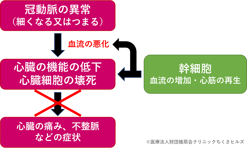 心臓の疾患に対する幹細胞治療