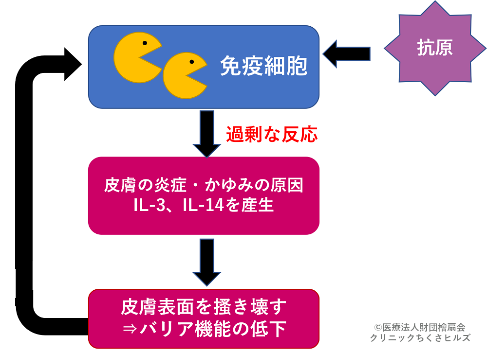 アトピー性皮膚炎の発生メカニズム