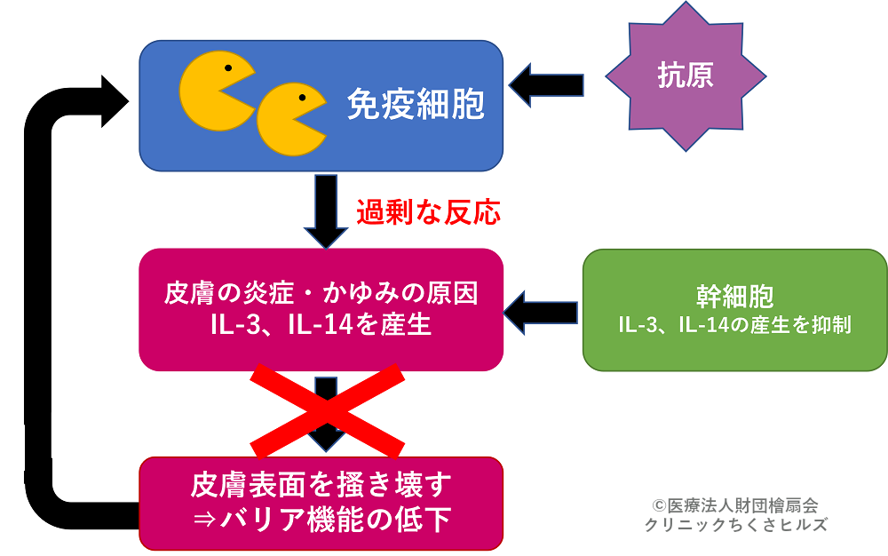 アトピー性皮膚炎に対する幹細胞治療